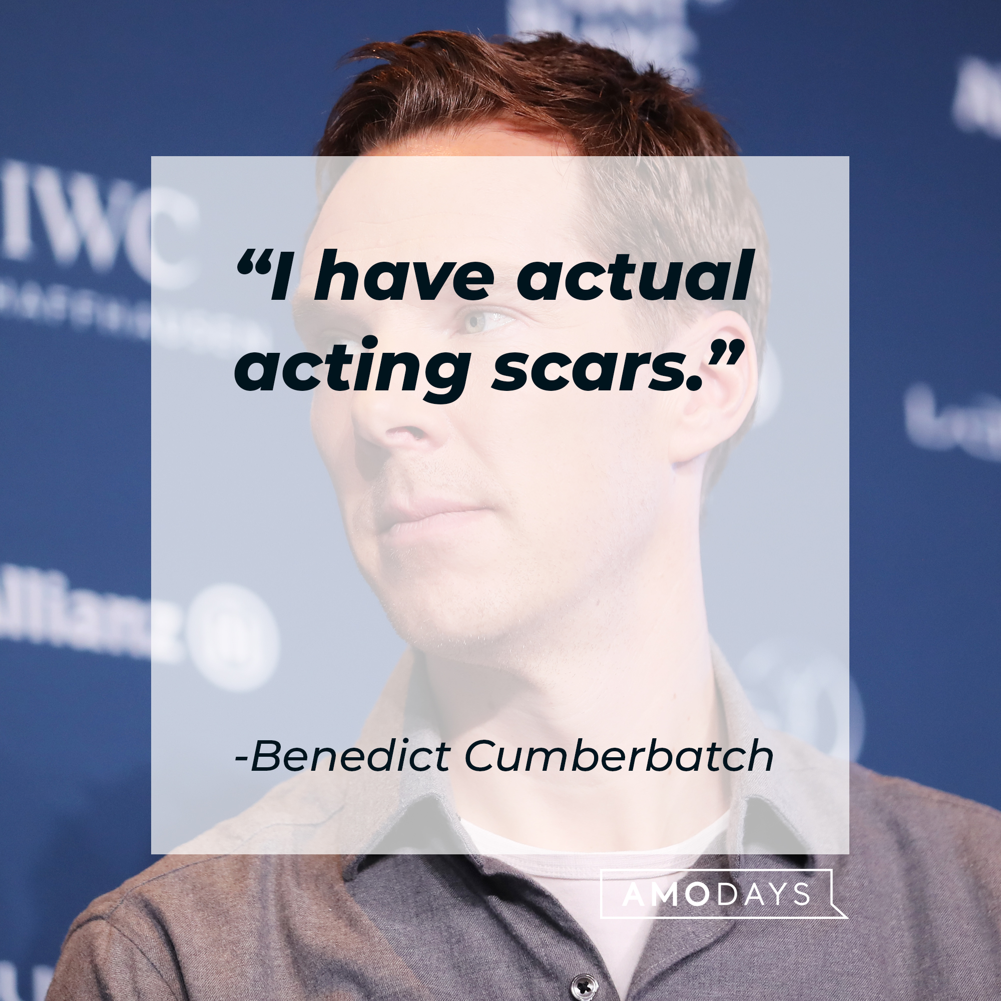 Benedict Cumberbatch, with his quote: “I have actual acting scars.” | Source: Getty Images