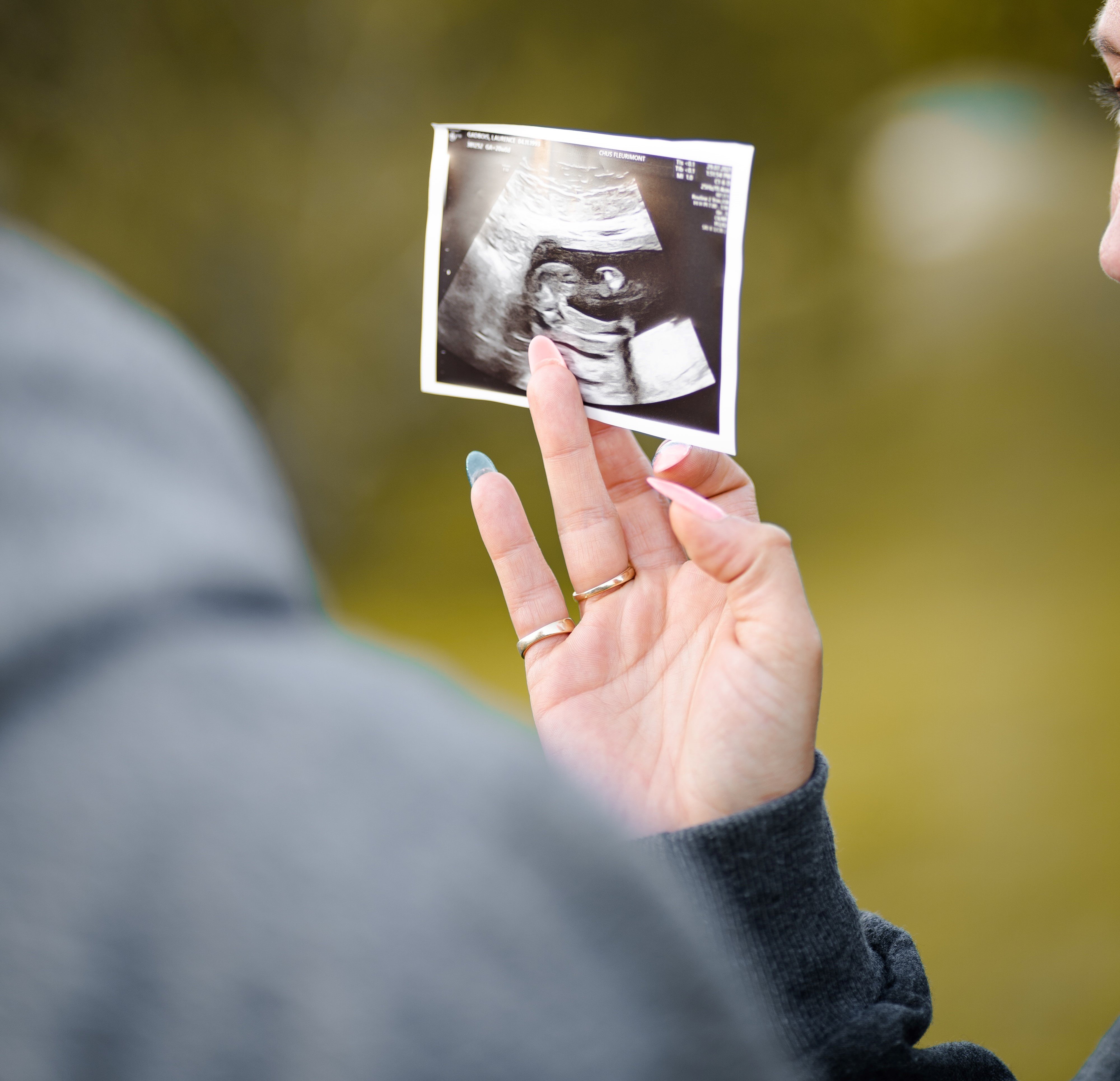 A scan revealed they were having twins. | Source: Unsplash